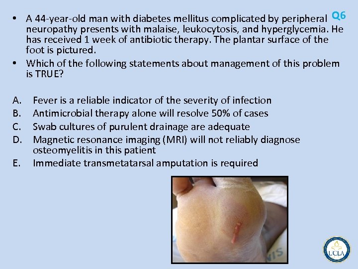  • A 44 year old man with diabetes mellitus complicated by peripheral Q