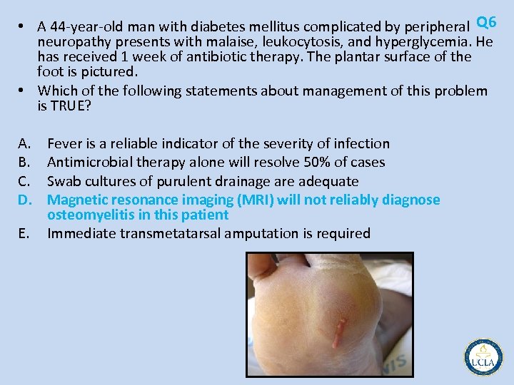  • A 44 year old man with diabetes mellitus complicated by peripheral Q