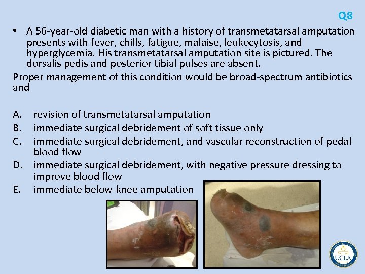 Q 8 • A 56 year old diabetic man with a history of transmetatarsal