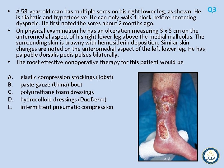  • A 58 year old man has multiple sores on his right lower