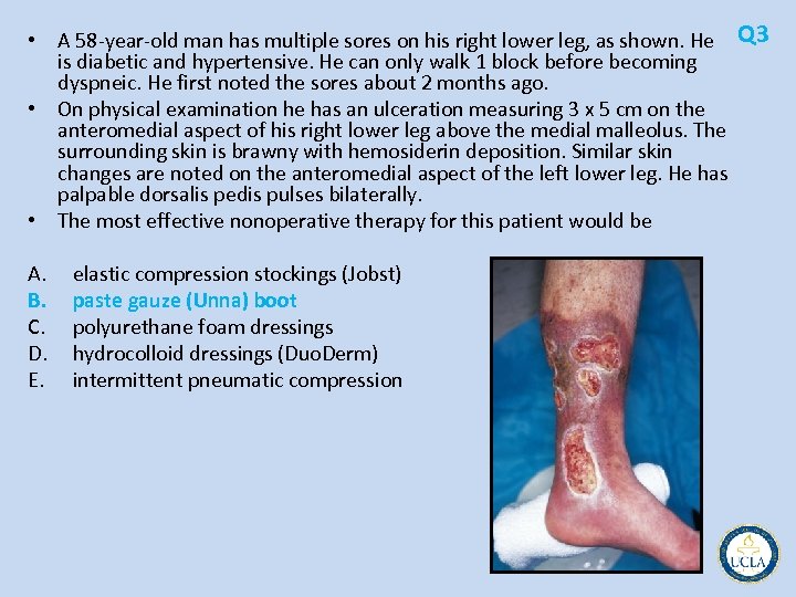  • A 58 year old man has multiple sores on his right lower