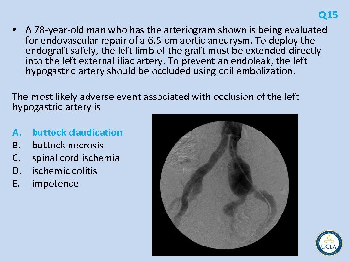 Q 15 • A 78 year old man who has the arteriogram shown is