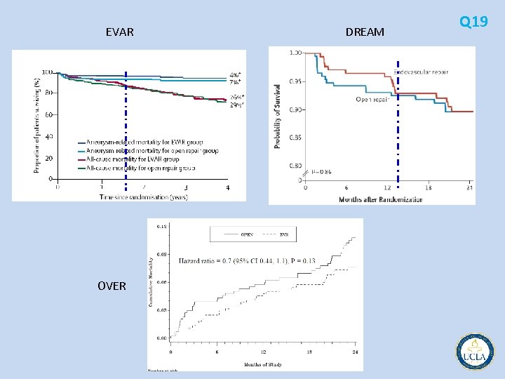 EVAR OVER DREAM Q 19 