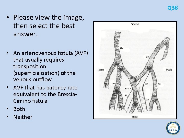 Q 38 • Please view the image, then select the best answer. • An