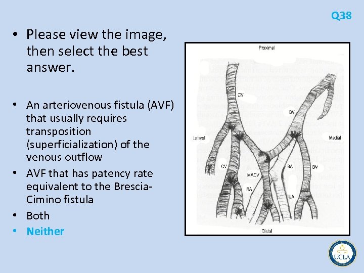 Q 38 • Please view the image, then select the best answer. • An