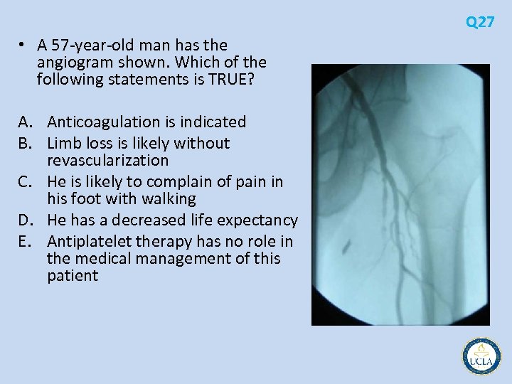 Q 27 • A 57 year old man has the angiogram shown. Which of