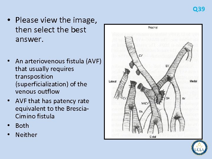 Q 39 • Please view the image, then select the best answer. • An