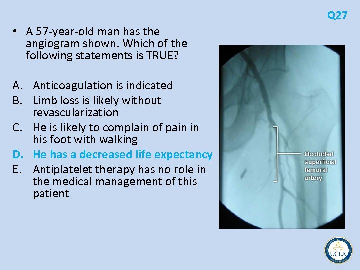 Q 27 • A 57 year old man has the angiogram shown. Which of
