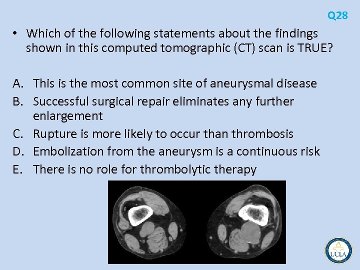 Q 28 • Which of the following statements about the findings shown in this
