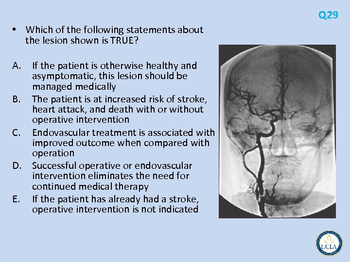 Q 29 • Which of the following statements about the lesion shown is TRUE?