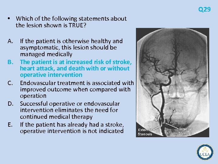 Q 29 • Which of the following statements about the lesion shown is TRUE?