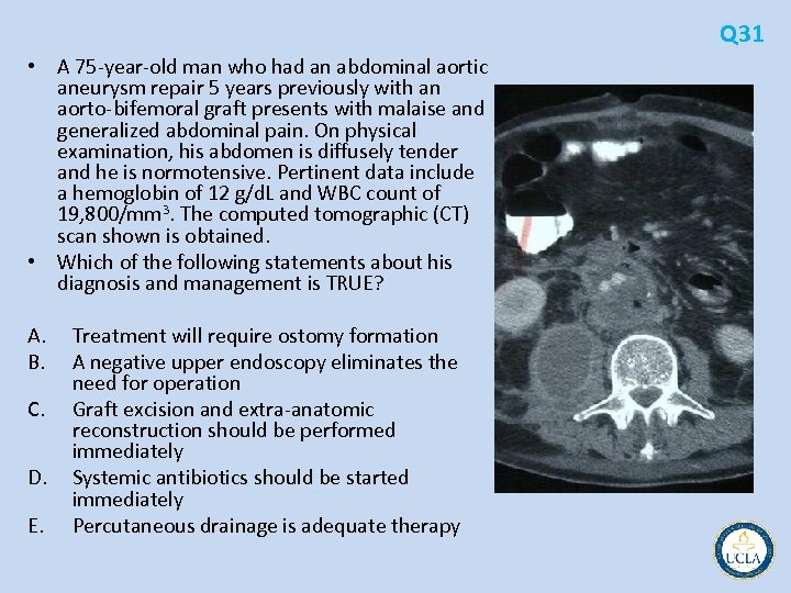 Q 31 • A 75 year old man who had an abdominal aortic aneurysm