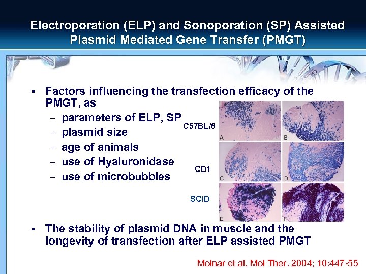 Electroporation (ELP) and Sonoporation (SP) Assisted Plasmid Mediated Gene Transfer (PMGT) § Factors influencing