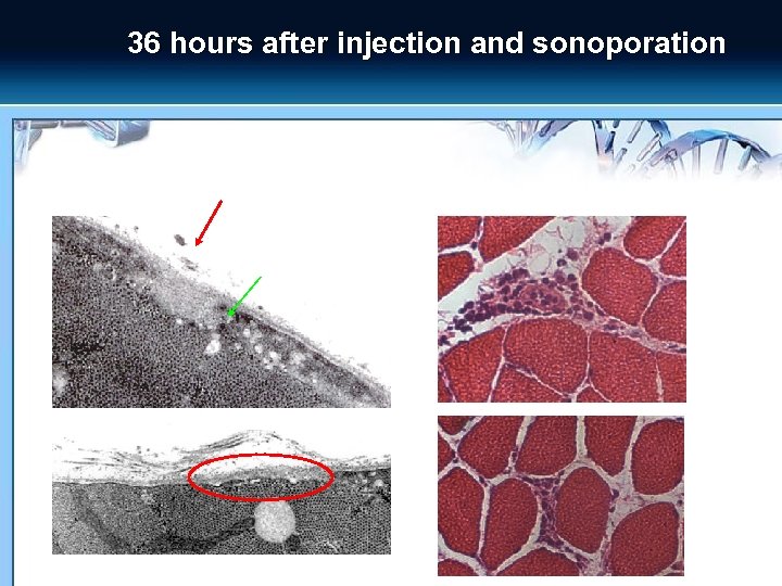 36 hours after injection and sonoporation 
