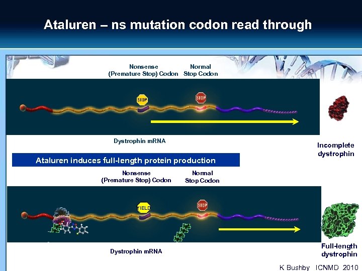 Ataluren – ns mutation codon read through Nonsense Normal (Premature Stop) Codon Stop Codon