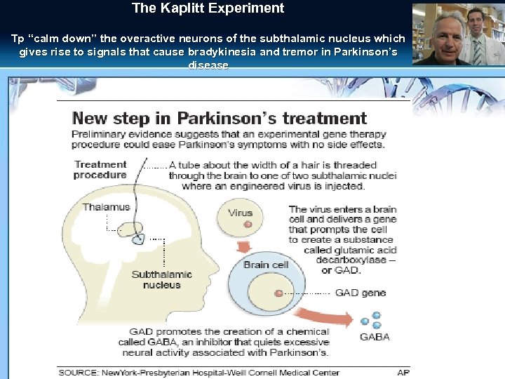 The Kaplitt Experiment Tp “calm down” the overactive neurons of the subthalamic nucleus which