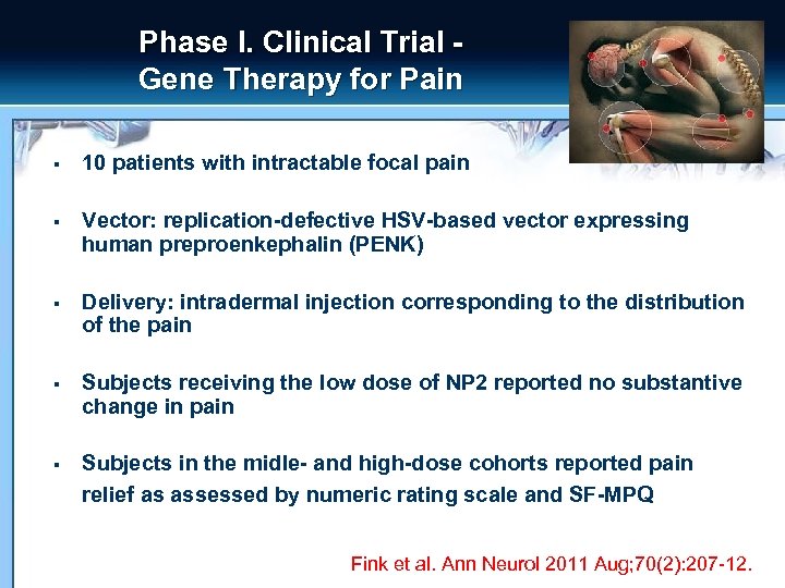 Phase I. Clinical Trial Gene Therapy for Pain § 10 patients with intractable focal
