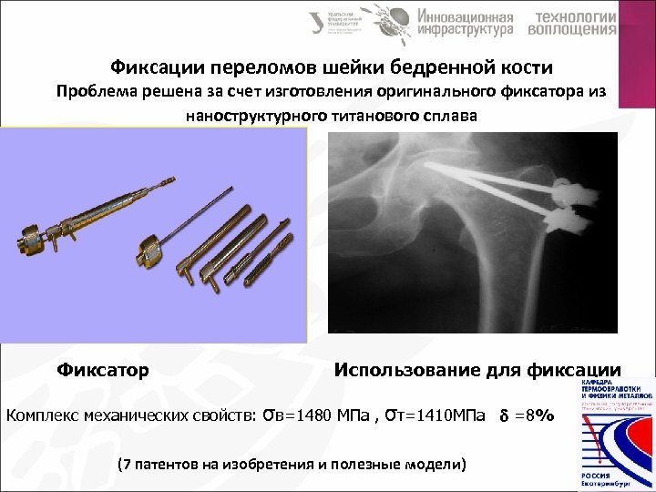 Фиксатор шейки. Фиксатор при переломе шейки бедра. Фиксация отломков с помощью трехгранного гвоздя. Догоспитальная фиксация отломков у детей.