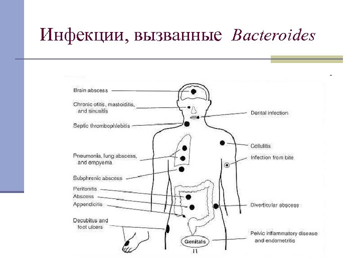 Инфекции, вызванные Bacteroides 