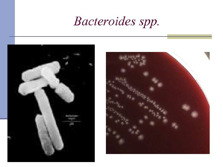 Bacteroides spp. 