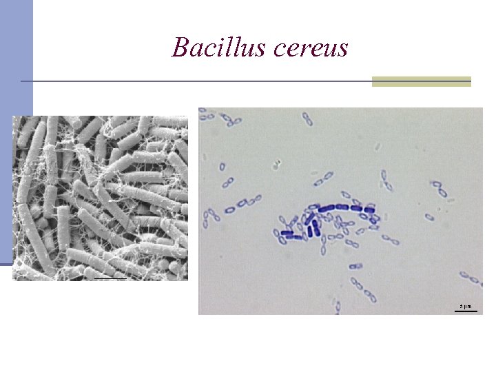 Bacillus сereus 