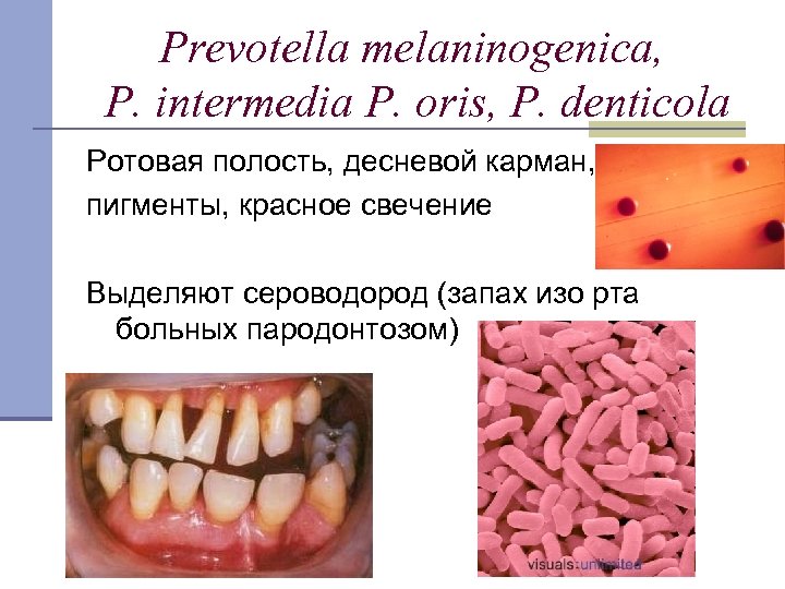 Prevotella melaninogenica, P. intermedia P. oris, P. denticola Ротовая полость, десневой карман, пигменты, красное