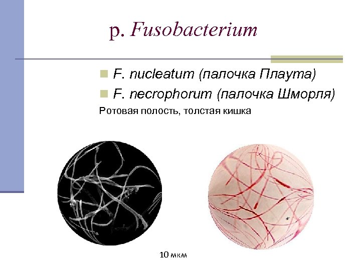 p. Fusobacterium n F. nucleatum (палочка Плаута) n F. necrophorum (палочка Шморля) Ротовая полость,