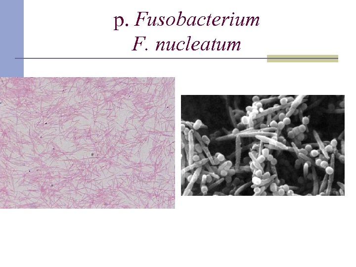 p. Fusobacterium F. nucleatum 