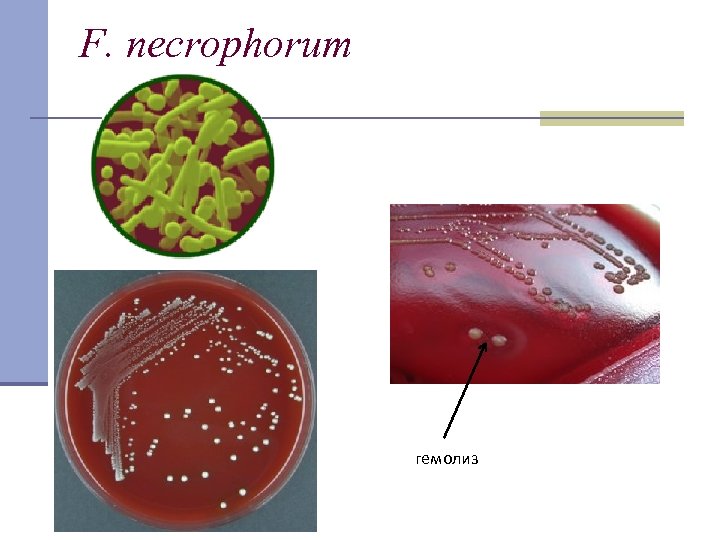 F. necrophorum гемолиз 