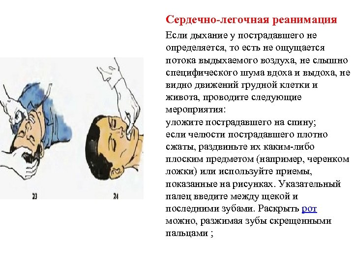 Первая помощь сердечно легочная реанимация презентация