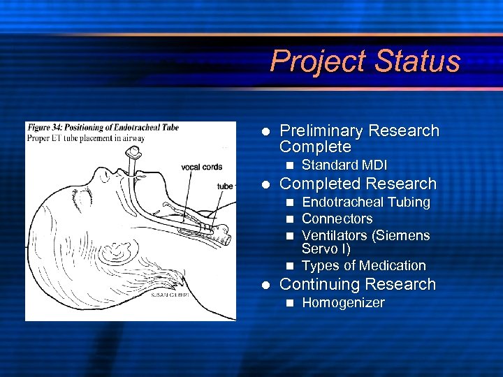 Project Status l Preliminary Research Complete n l Standard MDI Completed Research Endotracheal Tubing