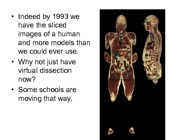  • Indeed by 1993 we have the sliced images of a human and