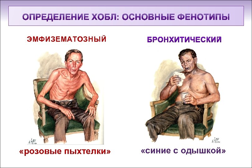 ЭМФИЗЕМАТОЗНЫЙ «розовые пыхтелки» «синие с одышкой» 