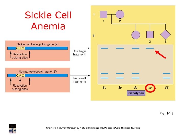Sickle Cell Anemia Fig. 14. 8 Chapter 14 Human Heredity by Michael Cummings ©