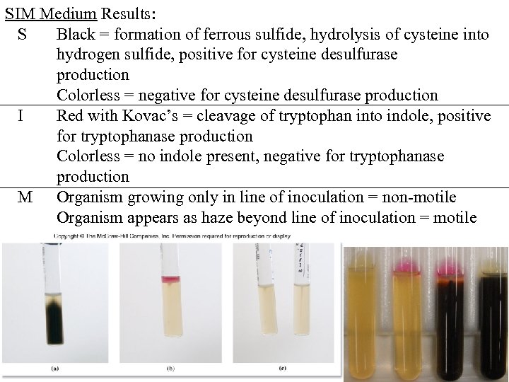 SIM Medium Results: S Black = formation of ferrous sulfide, hydrolysis of cysteine into