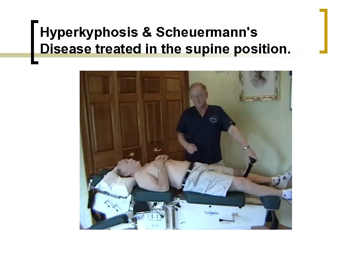 Hyperkyphosis & Scheuermann's Disease treated in the supine position. 