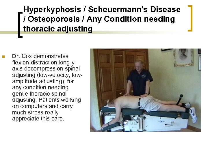 Hyperkyphosis / Scheuermann's Disease / Osteoporosis / Any Condition needing thoracic adjusting n Dr.