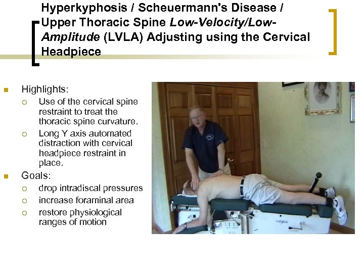 Hyperkyphosis / Scheuermann's Disease / Upper Thoracic Spine Low-Velocity/Low. Amplitude (LVLA) Adjusting using the
