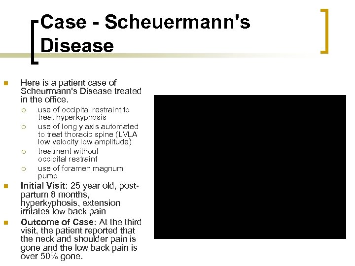 Case - Scheuermann's Disease n Here is a patient case of Scheurmann's Disease treated