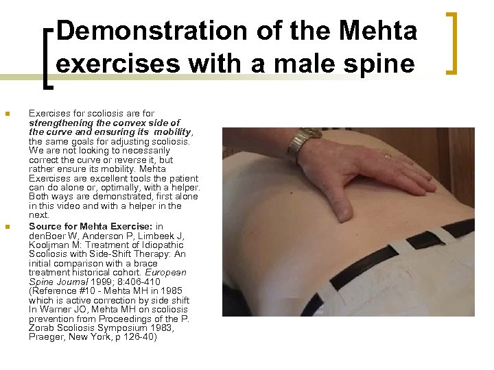 Demonstration of the Mehta exercises with a male spine n n Exercises for scoliosis