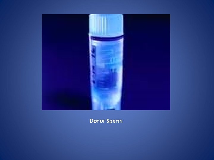 Donor Sperm 