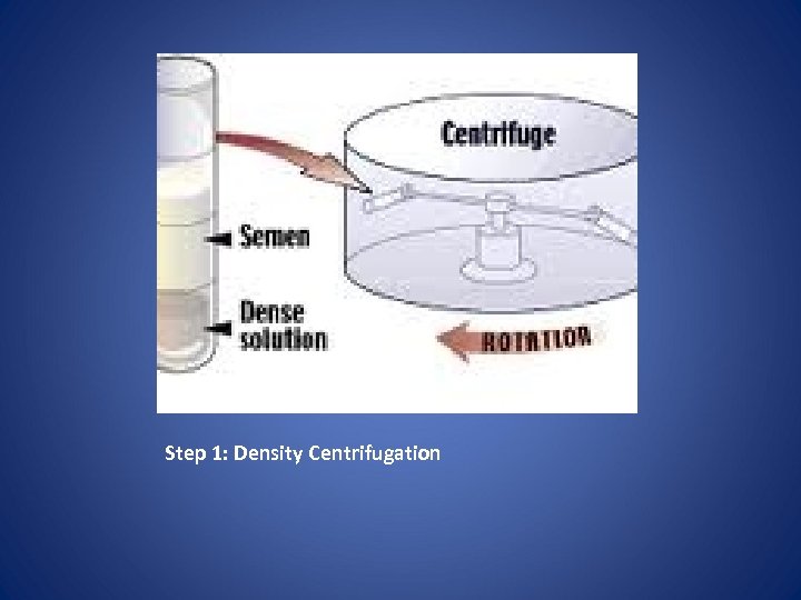 Step 1: Density Centrifugation 