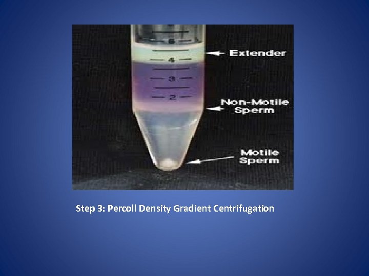 Step 3: Percoll Density Gradient Centrifugation 