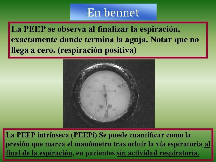 En bennet La PEEP se observa al finalizar la espiración, exactamente donde termina la