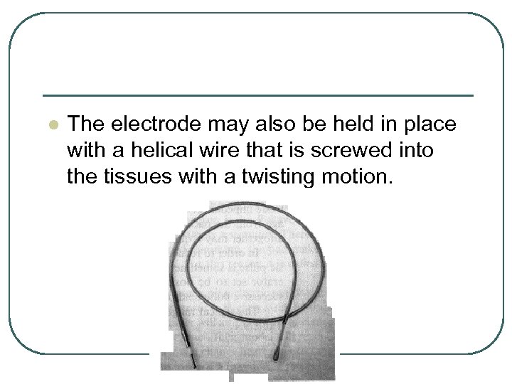 l The electrode may also be held in place with a helical wire that