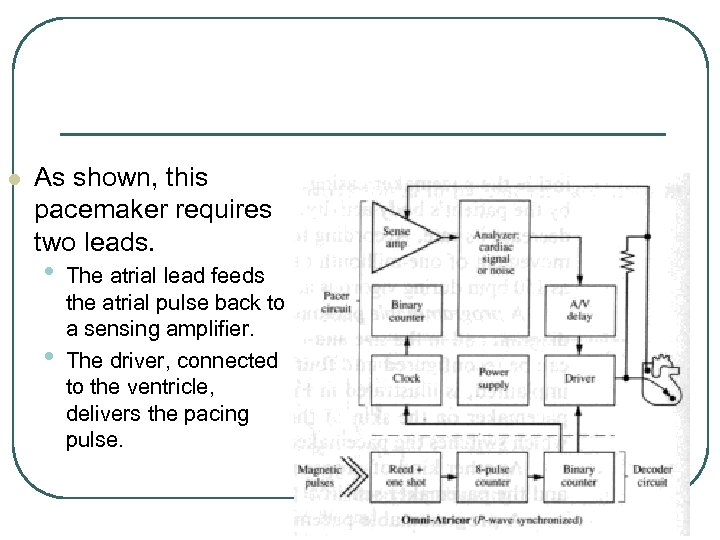 l As shown, this pacemaker requires two leads. • • The atrial lead feeds