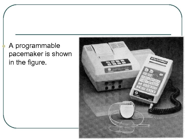 l A programmable pacemaker is shown in the figure. 