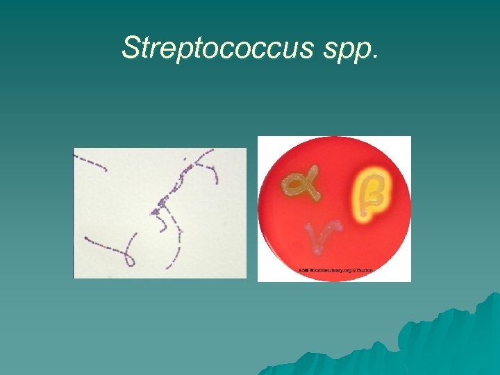 Streptococcus spp. 