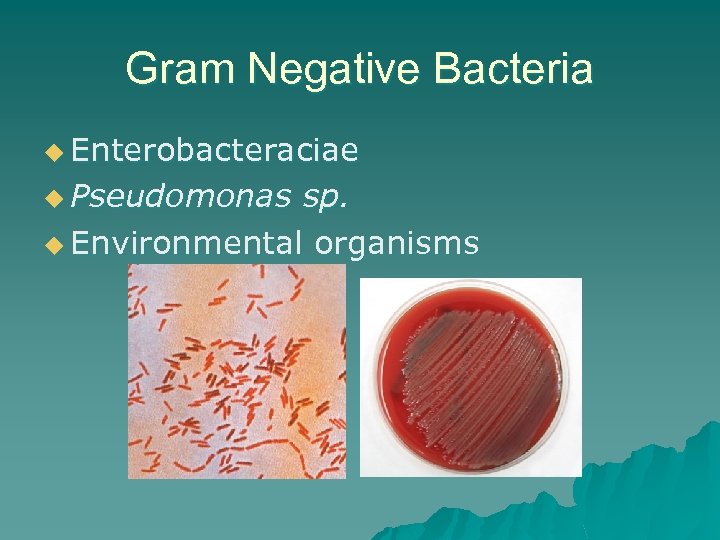 Gram Negative Bacteria u Enterobacteraciae u Pseudomonas sp. u Environmental organisms 