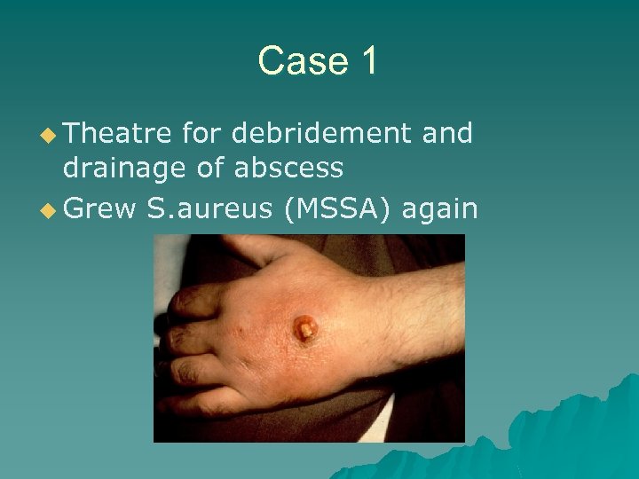 Case 1 u Theatre for debridement and drainage of abscess u Grew S. aureus